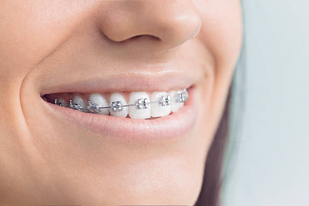 Best Traditional Braces  in Sonora, TX